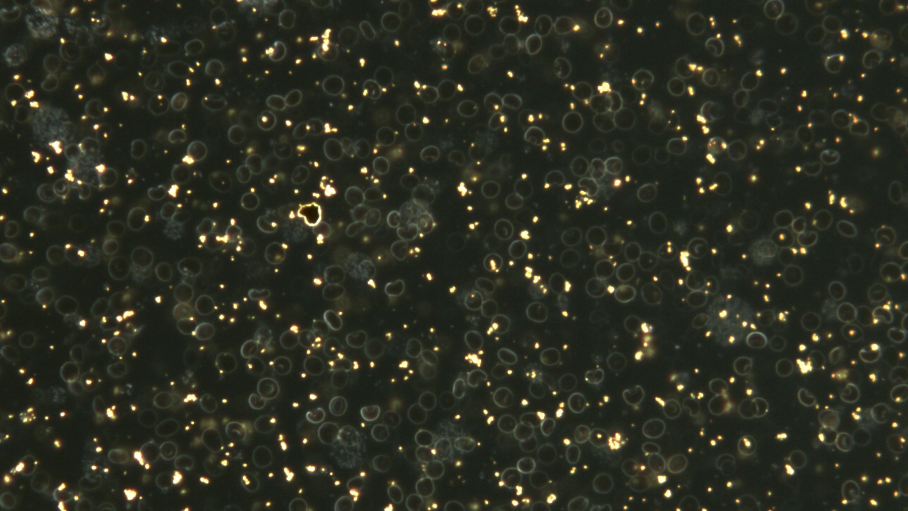 Darkfield microscopy of an assay, showing bright nanoparticle signals among blood cells and other sample features.